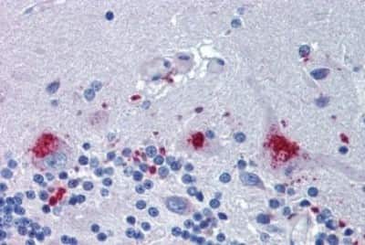 Immunohistochemistry-Paraffin: ERG28 Antibody [NBP3-14313]